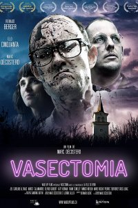 Вазэктомия 