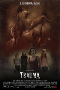 Травма 